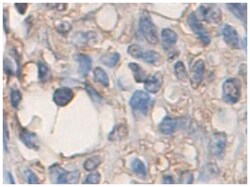 ADAMTS2, Rabbit, Polyclonal Antibody, Abnova 100 &mu;g | Buy Online | Abnova Corporation | Fisher Scientific