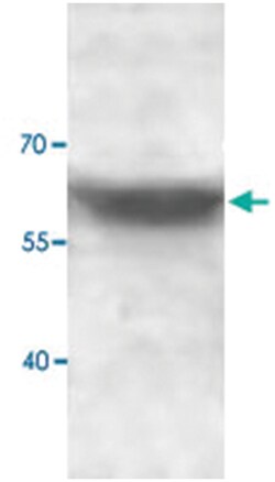 ADAMTSL1, Rabbit, Polyclonal Antibody, Abnova 100&mu;g; Unlabeled:Antibodies,