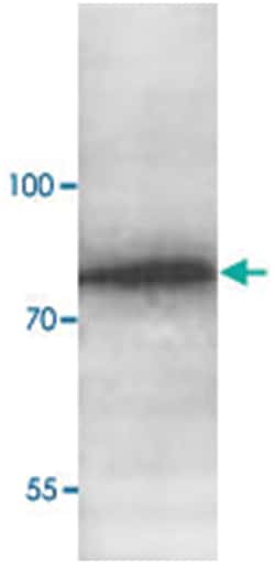 ABCG8 Rabbit anti-Human, Polyclonal Antibody, Abnova 100&mu;g; Unlabeled:Antibodies,