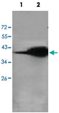 AKR7A2, Rabbit, Polyclonal Antibody, Abnova 100&mu;g; Unlabeled:Antibodies,