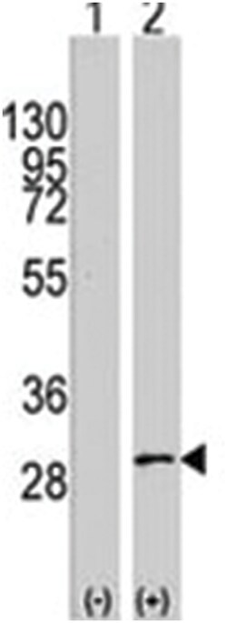 KITLG Rabbit anti-Human, Polyclonal Antibody, Abnova 400&mu;L; Unlabeled:Antibodies,