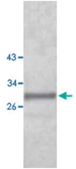 AQP9 Rabbit anti-Human, Polyclonal Antibody, Abnova 100&mu;g; Unlabeled:Antibodies,