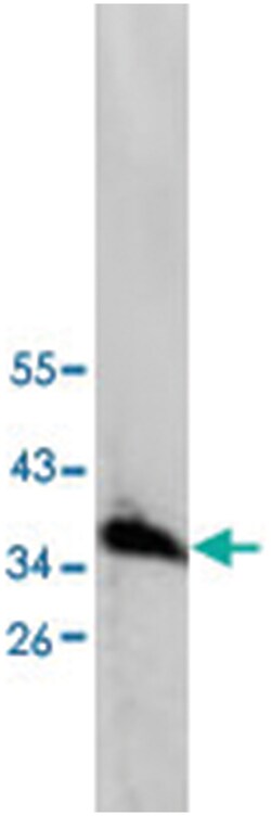 CASP7 Rabbit anti-Human, Polyclonal Antibody, Abnova 100&mu;g; Unlabeled:Antibodies,