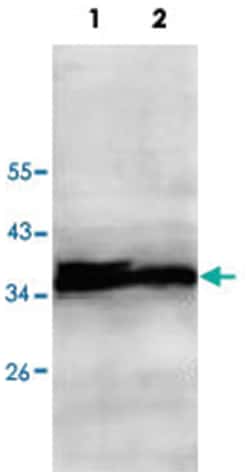 ECH1, Rabbit, Polyclonal Antibody, Abnova 100&mu;g; Unlabeled:Antibodies,