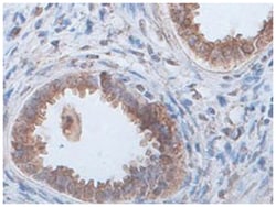 ECH1, Rabbit, Polyclonal Antibody, Abnova 100&mu;g; Unlabeled:Antibodies,