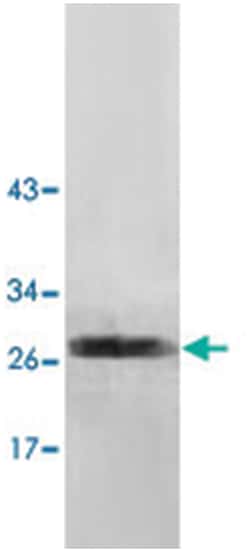 NUDT7, Rabbit, Polyclonal Antibody, Abnova 100&mu;g; Unlabeled:Antibodies,
