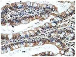 NUDT7, Rabbit, Polyclonal Antibody, Abnova 100&mu;g; Unlabeled:Antibodies,