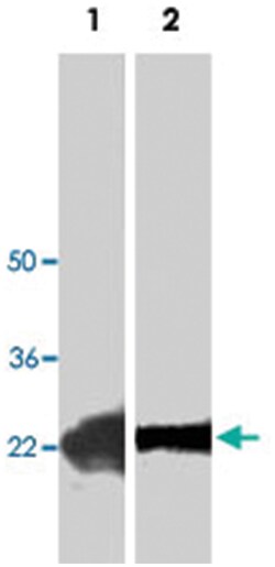 PDGFC, Rabbit, Polyclonal Antibody, Abnova 100&mu;g; Unlabeled:Antibodies,
