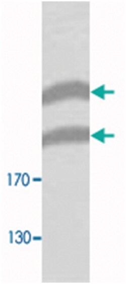 PLXNB1 Rabbit anti-Human, Mouse, Rat, Polyclonal Antibody, Abnova 100 &mu;g | Buy Online | Abnova | Fisher Scientific