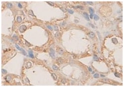 PLXNB1 Rabbit anti-Human, Mouse, Rat, Polyclonal Antibody, Abnova 100 &mu;g | Buy Online | Abnova | Fisher Scientific