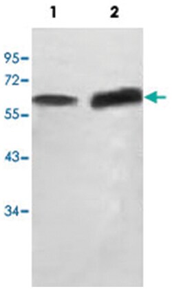 SCP2, Rabbit, Polyclonal Antibody, Abnova 100&mu;g; Unlabeled:Antibodies,