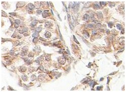 SCP2, Rabbit, Polyclonal Antibody, Abnova 100&mu;g; Unlabeled:Antibodies,