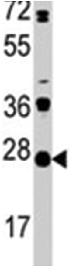 CD3G, Rabbit, Polyclonal Antibody, Abnova 400 &mu;L | Buy Online | Abnova Corporation | Fisher Scientific