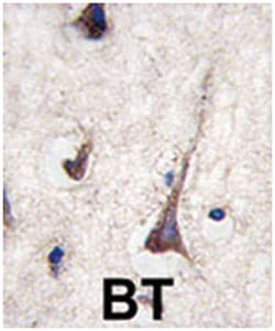 CD3G, Rabbit, Polyclonal Antibody, Abnova 400 &mu;L | Buy Online | Abnova Corporation | Fisher Scientific