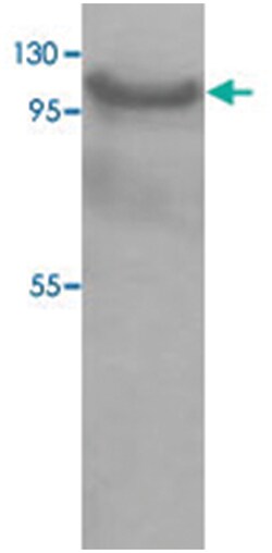 USO1, Rabbit, Polyclonal Antibody, Abnova 100&mu;g; Unlabeled:Antibodies,