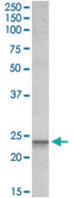 BBC3, Goat, Polyclonal Antibody, Abnova 100&mu;g; Unlabeled:Antibodies,