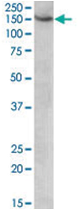 AGTPBP1, Goat, Polyclonal Antibody, Abnova 100&mu;g; Unlabeled:Antibodies,