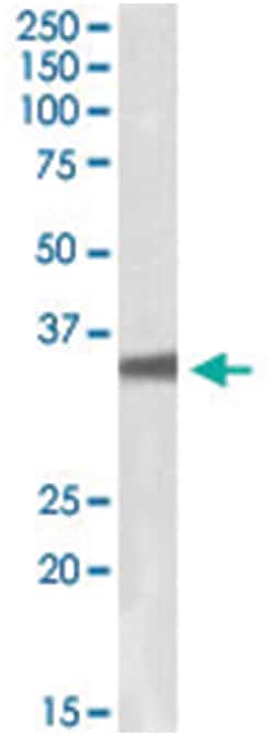 GNB3 Goat anti-Human, Polyclonal Antibody, Abnova 100&mu;g; Unlabeled:Antibodies,