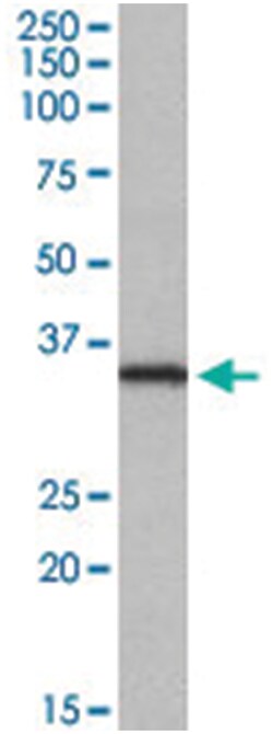 NEK7 Goat anti-Human, Polyclonal Antibody, Abnova 100μg; Unlabeled:Antibodies,