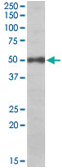 EIF3E, Goat, Polyclonal Antibody, Abnova 100&mu;g; Unlabeled:Antibodies,
