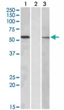 MGAT1, Goat, Polyclonal Antibody, Abnova 100&mu;g; Unlabeled:Antibodies,