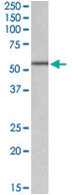 ALDH6A1 Goat anti-Human, Mouse, Rat, Polyclonal Antibody, Abnova 100&mu;g;