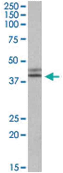 IDH1 Goat anti-Human, Polyclonal Antibody, Abnova 100 &mu;g | Buy Online | Abnova Corporation | Fisher Scientific