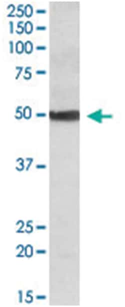 CYP24A1, Goat, Polyclonal Antibody, Abnova 100&mu;g; Unlabeled:Antibodies,