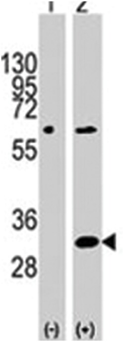 EIF4E2, Rabbit, Polyclonal Antibody, Abnova 400&mu;L; Unlabeled:Antibodies,
