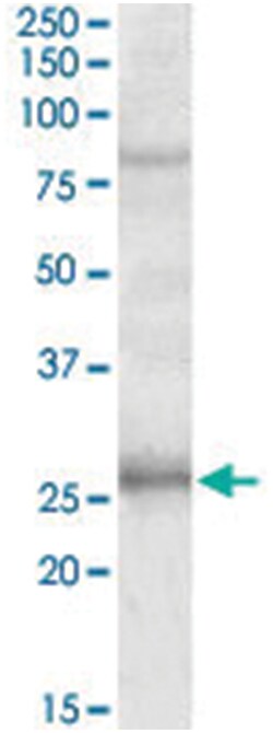 GPRIN3, Goat, Polyclonal Antibody, Abnova 100 &mu;g | Buy Online | Abnova Corporation | Fisher Scientific