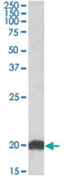NDUFS6, Goat, Polyclonal Antibody, Abnova 100&mu;g; Unlabeled:Antibodies,