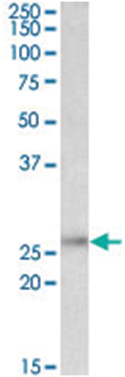 UCHL1 Goat anti-Human, Rat, Polyclonal Antibody, Abnova 100&mu;g; Unlabeled:Antibodies,