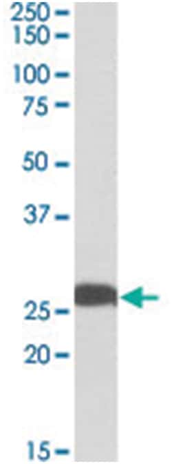UCHL1 Goat anti-Human, Rat, Polyclonal Antibody, Abnova 100&mu;g; Unlabeled:Antibodies,