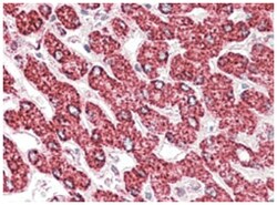 ETFB Goat anti-Human, Mouse, Rat, Polyclonal Antibody, Abnova 100&mu;g;