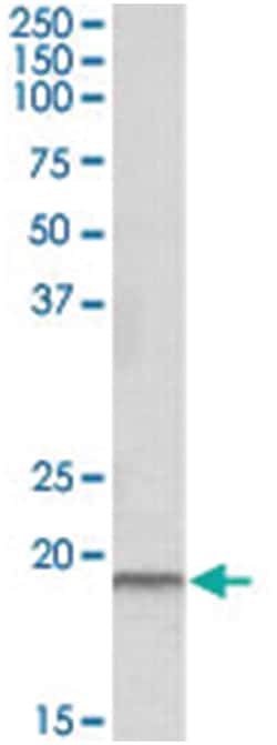 SPINT2 Goat anti-Human, Polyclonal Antibody, Abnova 100&mu;g; Unlabeled:Antibodies,