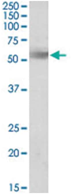 Rhbg, Goat, Polyclonal Antibody, Abnova 100 &mu;g | Buy Online | Abnova Corporation | Fisher Scientific