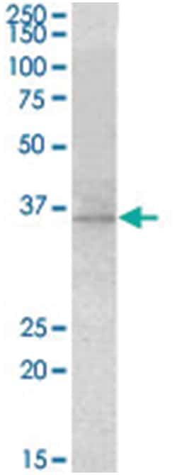 RDH5 Goat anti-Mouse, Polyclonal Antibody, Abnova 100&mu;g; Unlabeled:Antibodies,