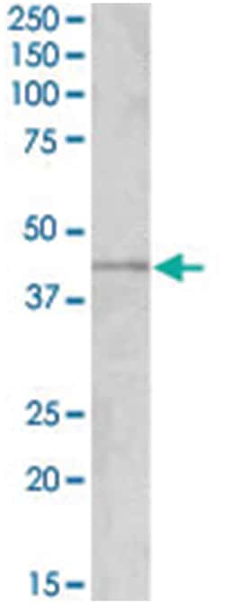 GRAMD3, Goat, Polyclonal Antibody, Abnova 100&mu;g; Unlabeled:Antibodies,