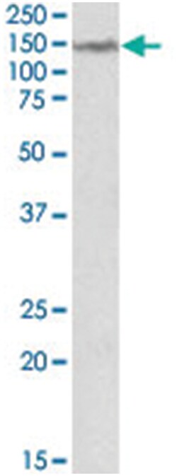 LMTK2, Goat, Polyclonal Antibody, Abnova 100 &mu;g | Buy Online | Abnova Corporation | Fisher Scientific