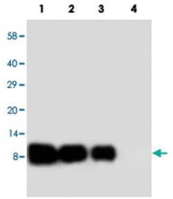 IL8 Rabbit anti-Human, Polyclonal Antibody, Abnova 100&mu;g; Unlabeled:Antibodies,