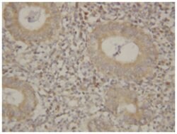 IL8 Rabbit anti-Human, Polyclonal Antibody, Abnova 100&mu;g; Unlabeled:Antibodies,