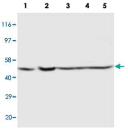 PSEN2, Rabbit, Polyclonal Antibody, Abnova 100&mu;g; Unlabeled:Antibodies,