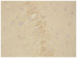 PSEN2, Rabbit, Polyclonal Antibody, Abnova 100&mu;g; Unlabeled:Antibodies,