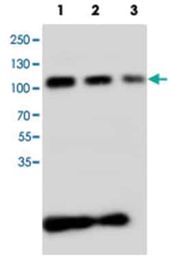 CDH3 Rabbit anti-Human, Polyclonal Antibody, Abnova 100&mu;g; Unlabeled:Antibodies,