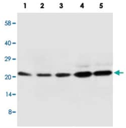 CDC42 Rabbit anti-Bovine, Human, Mouse, Rat, Polyclonal Antibody, Abnova 100 &mu;g | Buy Online | Abnova Corporation | Fisher Scientific
