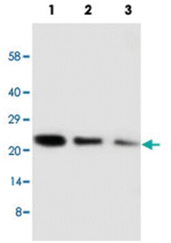 CDC42 Rabbit anti-Bovine, Human, Mouse, Rat, Polyclonal Antibody, Abnova 100 &mu;g | Buy Online | Abnova Corporation | Fisher Scientific