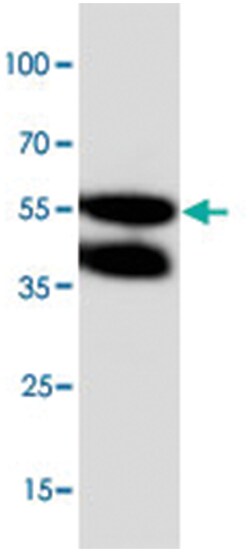 GJA5 Rabbit anti-Human, Rat, Polyclonal Antibody, Abnova 100&mu;g; Unlabeled:Antibodies,