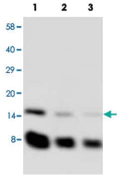 IGF1 Rabbit anti-Human, Rat, Polyclonal Antibody, Abnova 100&mu;g; Unlabeled:Antibodies,