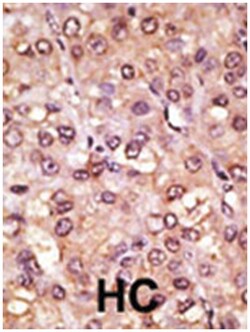 ASCL1, Rabbit, Polyclonal Antibody, Abnova 400&mu;L; Unlabeled:Antibodies,