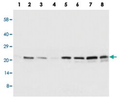 SOCS2 Rabbit anti-Human, Rat, Polyclonal Antibody, Abnova 100&mu;g; Unlabeled:Antibodies,